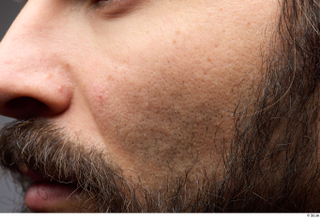 HD Face Skin Turgen cheek face nose skin pores skin…